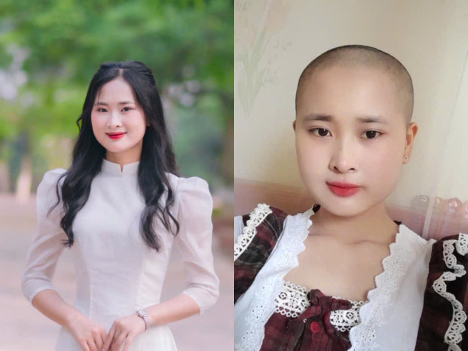 年轻癌症患者的震惊